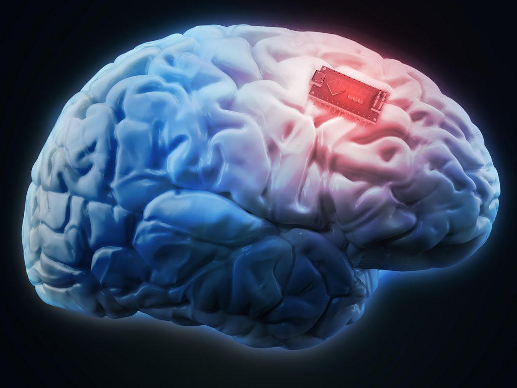 Human brain implant 